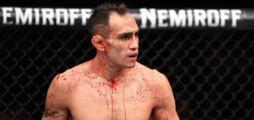 Tony Ferguson